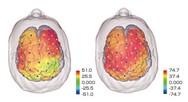 脳活動の見える化で、効果を実感02