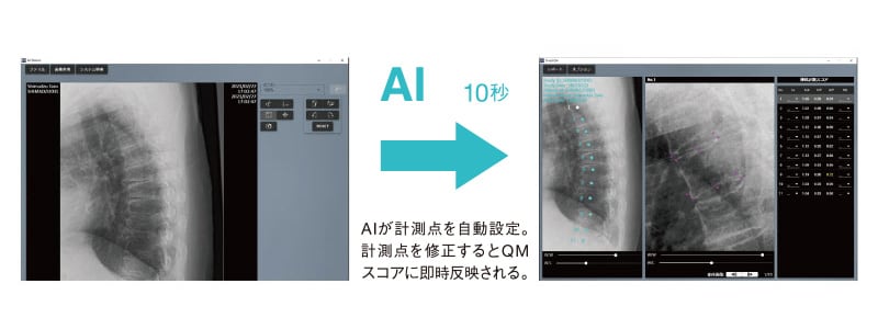 AIが計測点を自動設定。計測点を修正するとQMスコアに即時反映される。