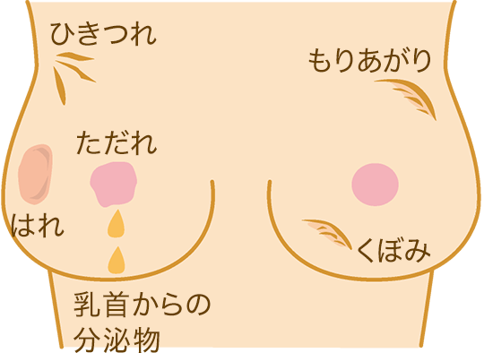 チェックポイント