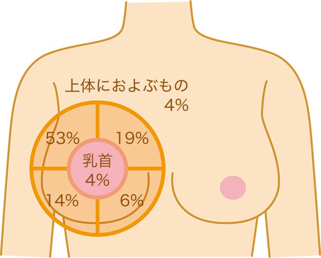 乳がんのほぼ半数がこのあたりにできます