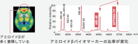 アミロイドβが多く蓄積している　の比率が変化