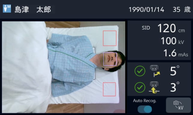 患者情報・撮影条件や3Dカメラ(オプション)で取得した映像をセカンドモニタへ表示(cタイプ)