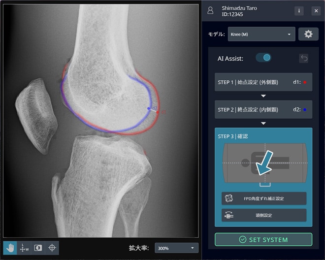 位置補正用画像解析ソフトウェア「Ortho-Navi」の画面 矢印でＸ線管保持器が移動する方向を示している