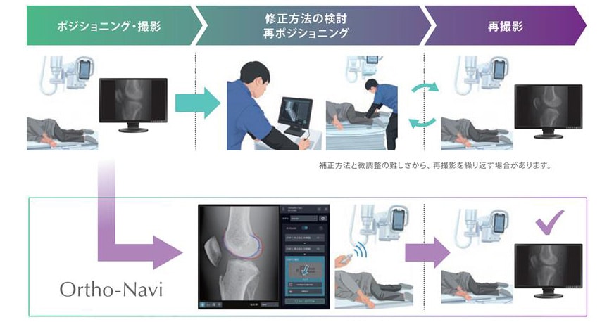 SHIMADZU] 難易度の高い膝関節側面の撮影を自動で補正 位置補正用画像