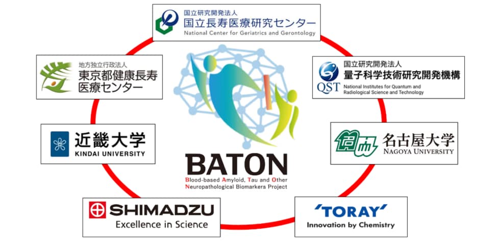 血液検査による認知症診断：実用化を加速 認知症の早期診断や効果的な予防法・治療法の開発に貢献
