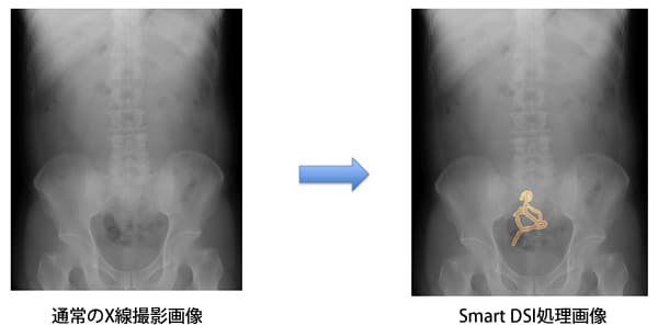 見てわかりやすい、遺残物の可能性を強調表示する「遺残確認支援ソフトウェアSmart DSI」