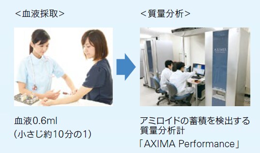 ヘルスケア 島津製作所の取り組み 認知症