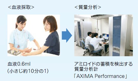 ヘルスケア　島津製作所の取り組み　認知症